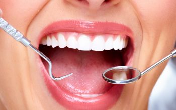 What to expect when you get a tooth filling?